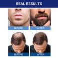 thumbnail image 3 of Tratamiento para el crecimiento del cabello Kirkland Signature Minoxidil 5%, 3 of 3