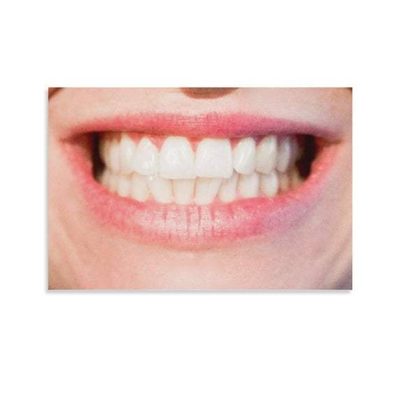 Women White Teeth Poster Decorative Painting Canvas Wall Art Living Room Posters Bedroom Painting,Unframe-style,28×41inch (70×105cm)