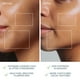 thumbnail image 5 of FOREO Bear 2 go - Dispositivo facial tonificante de microcorriente apto para viajes - Para líneas finas y arrugas - Antienvejecimiento - Esculpir el rostro - Estiramiento facial completo instantáneo -, 5 of 5