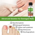 thumbnail image 6 of Toenail Fungus Treatment-Extra Strength Nail Fungus Solution for Toenail & Fingernail, for Thick Cracked Discolored Nails, Restore Nail Health, 6 of 8