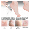 thumbnail image 4 of "Aparato De Pedicura Eléctrico Con Papel De Lija Para Pies Malubero, Rosa ", 4 of 5