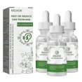 thumbnail image 1 of 3Pcs Tinnitus Ear Drops Treatment Itching Earache Hard Hearing Tinnitus Symptoms Swelling Otitis Care Ear Ringing Relieving Oil 20ml, 1 of 5