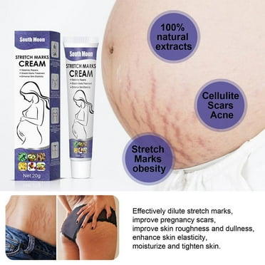 YUEYAN 20g Stretch Marks Removal Cream Eliminate Maternity Skin Cream Firming