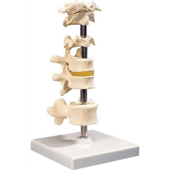 3B Anatomical Model - 5 Mounted Vertebrae with Removable Stand