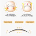 thumbnail image 1 of Ingrown Nail Corrector, Exfoliate Dead Skin Toenail Correction Patch Lightweight Professional Design  For   For Toenail, 1 of 8