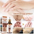 thumbnail image 3 of Dark Knuckle Whitening Serum Hand Elbow Knee Brightening Serum Skin Moisturizer, 3 of 3
