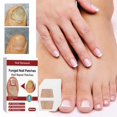 thumbnail image 3 of Nail Renewal Fungal Patches Nail Treatment Patches&Damaged Rough& T H Thick, 3 of 8