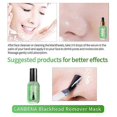 thumbnail image 5 of high qualityBlackhead Remover Serum With 100 Strips, Blackhead Remover Mask Peel Off Blackhead Mask 2 in 1 Green Tea Oil Blackhead Removal, 5 of 5