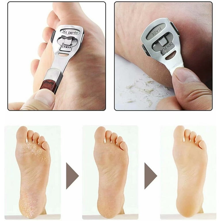 Callus Shaver Sets Include 10 Replacement Slices Callus Shavers Foot Care  Tools Hard Skin Remover For Hand Feet
