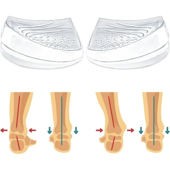 1 Pairs 2 Layers Medial & Lateral Heel Wedge Silicone Insoles - Corrective Adhesive Shoe Inserts for Foot Alignment, Knock Knee Pain, Bow Legs, Osteoarthritis for Men and Women(Large)
