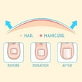 thumbnail image 6 of Herrnalise Ingrown Toenail Straightening Clip Stainless Steel Toenail Correction Clip Toenail Inset Buckle Toe Pedicure Tool, 6 of 9