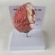 thumbnail image 3 of Modelo de Enfermedad del Cerebro Humano - Patología Cerebral Hemorragia del Encefálico Modelo de Enseñanza Médica - Modelo de Anatomía del Cerebro Humano, 3 of 5