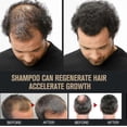 thumbnail image 5 of Root Activator Shampoo, Mane Root Activator Shampoo, Shampoo Root Activator Promotes Hair Growth For Men Hair Thickening Shampoo - Sjue, 5 of 5