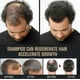 thumbnail image 5 of Root Activator Shampoo, Mane Root Activator Shampoo, Shampoo Root Activator Promotes Hair Growth For Men Hair Thickening Shampoo - Sjue, 5 of 5