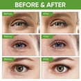 thumbnail image 2 of Eye Cream for Puffy Eyes and Dark Circles, Eye Tightener Cream For Under Eye Bags, Eye Serum Eye Bags Treatment For Women, 2 of 9