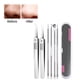thumbnail image 5 of Xihbxyly Kit de Eliminación de Puntos Negros, Extractores Profesionales de Acero Inoxidable, Mango Antideslizante, Estuche Portátil, Rutina de Cuidado de La Piel, Artículos Esenciales de Belleza para, 5 of 6