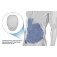 thumbnail image 3 of Soporte para hernia, hernia única, tratamiento escrotal inguinal, lado izquierdo o derecho, mediano (lado derecho), 3 of 5