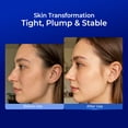 thumbnail image 4 of Hyaluronic Acid Face Serum, Hydrating Anti-Aging Serum with Peptides, Fast Redness Relief & Repair, for Daily Facial Care & Microneedling Post-Treatment, Soothing for Sensitive Skin, 4 of 8