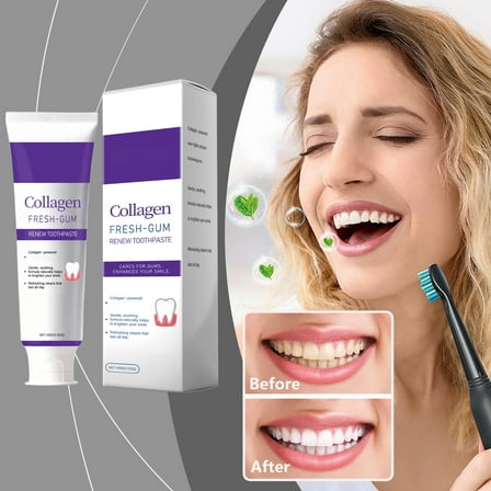 Kreain Nature Whitening Toothpaste, Fresh Breath Formula, Natural Oral Care & Enamel Repair, Helps Remove Coffee, Tea & Wine Stains, Fresh Minty Gel, 3.5 Oz Tube