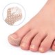 thumbnail image 4 of Parche para uñas encarnadas, parche aislante para surcos de uñas, corrector de perforación de uñas, juego de herramientas de pedicura, 10 piezas por pieza, 4 of 4
