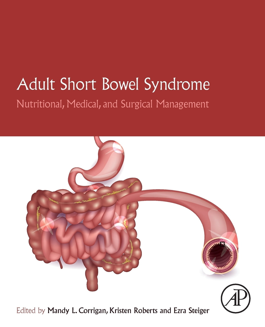 Adult Short Bowel Syndrome Nutritional Medical And Surgical Adult Short Bowel Syndrome Nutritional Medical And Surgical