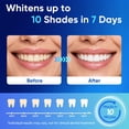 thumbnail image 3 of MySmile Teeth Whitening Gel Refill, Carbide Peroxide Whitening Gel for Teeth Whitening Kit, Gentle Non-Sensitive & Enamel Safe, Not Include Teeth Whitening Light, 5Pcs x 3ml,  Economy Packaging, 3 of 8