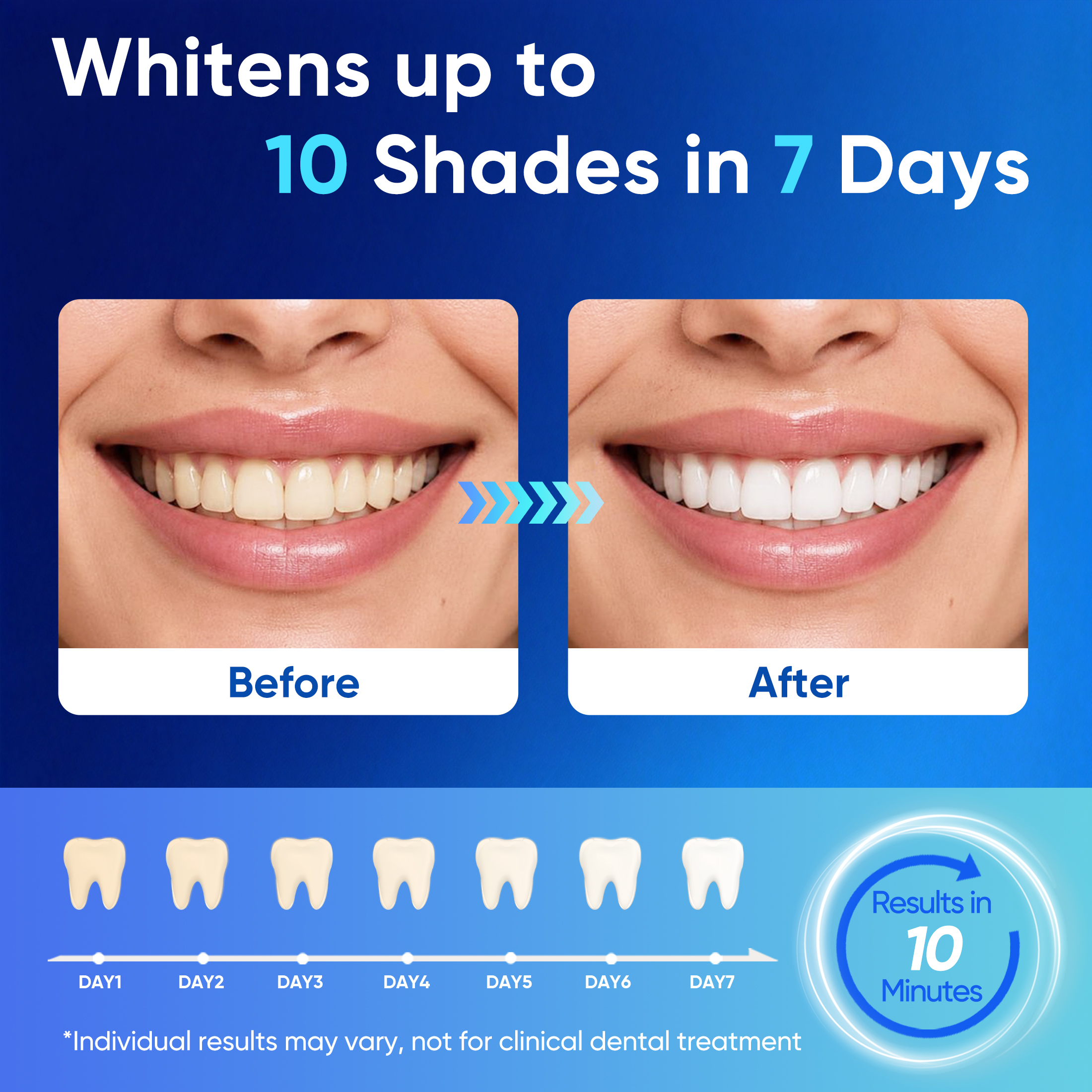 MySmile Pro Teeth Whitening Kit with 28-LED Light photo 6