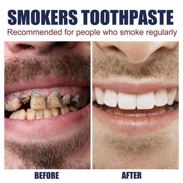 are herbal cigarettes good for quitting smoking Health Hazards Of Herbal Cigarettes