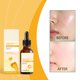 thumbnail image 4 of Aceite Iluminador de Jengibre Amarillo para Manchas Oscuras y Enrojecimiento | 30 Ml: Brillo y Nutrición de Larga Duración, 4 of 7