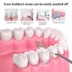 thumbnail image 3 of Escalador Dental ultrasónico para eliminar manchas de sarro de dientes, eliminador de cálculo de dientes, limpiador de placa de dientes sónico eléctrico, eliminación de piedra Dental WD.WDQZL Cocina, 3 of 5