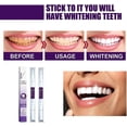 thumbnail image 3 of Hismile V34 Colour Corrector Teeth Whitening Gel Pen, Tooth Stain Removal 1-10pcs, 3 of 5