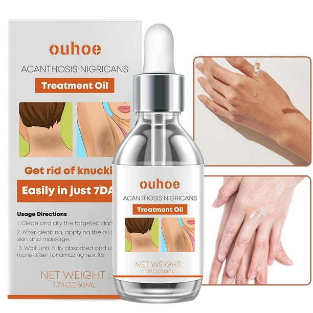 Dark Spots CorrectorUnderarm Cream Acanthosis Nigricans Therapy Oil Essence For Armpit Knees