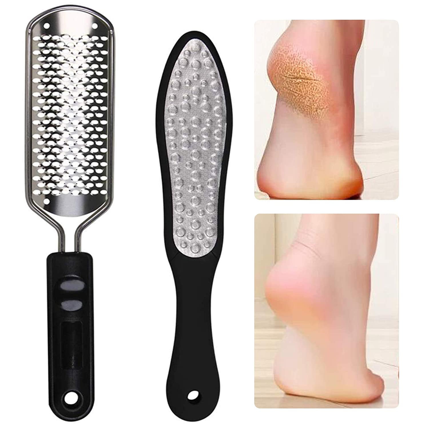 LoveBB 2Pcs Pedicure Rasp Foot File Callus Remover,Professional Stainless  Steel Colossal and Fine Foot Scrubber Remove Dead Skin for We
