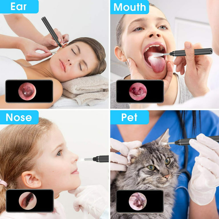 Wireless Otoscope Earwax Removal Tool For Adults Kids & Pets