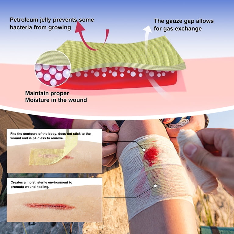 Ceeport Xeroform Petrolatum Dressing 4x4, Non-Adherent Medical Gauze Pad Strip, Soft Fine Mesh Gauze Patch for Wound Care, Burns, Lacerations, Skin ... Ceeport Xeroform Petrolatum Dressing 4x4, Non-Adherent Medical Gauze Pad Strip, Soft Fine Mesh Gauze Patch for Wound Care, Burns, Lacerations, Skin ...