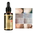 thumbnail image 1 of Scar Removal Lavender Cream For , Stretch Marks, Burn Skin Bio Regulation, Nourishing, 1 of 8