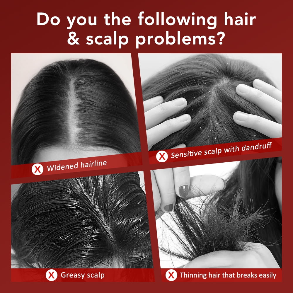 Hair Scalp Massage, 660nm Red Light Oil Applicator  Hair Care Hai rbrush Essence Oil Nourishes Scalp Brush