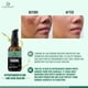 thumbnail image 5 of Aceite de Tamanu Orgánico Caraway Piel Método Ayurvédico 50 ml Indian Origin, 5 of 9
