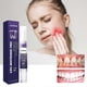thumbnail image 2 of Teeth Repair Gel, Oral Repair Gel, Healthy Gums, Breath Freshener, Stain Removes, Strengthens Teeth, Oral Care Cleaner, v34 Whitening Gel, 2 of 5