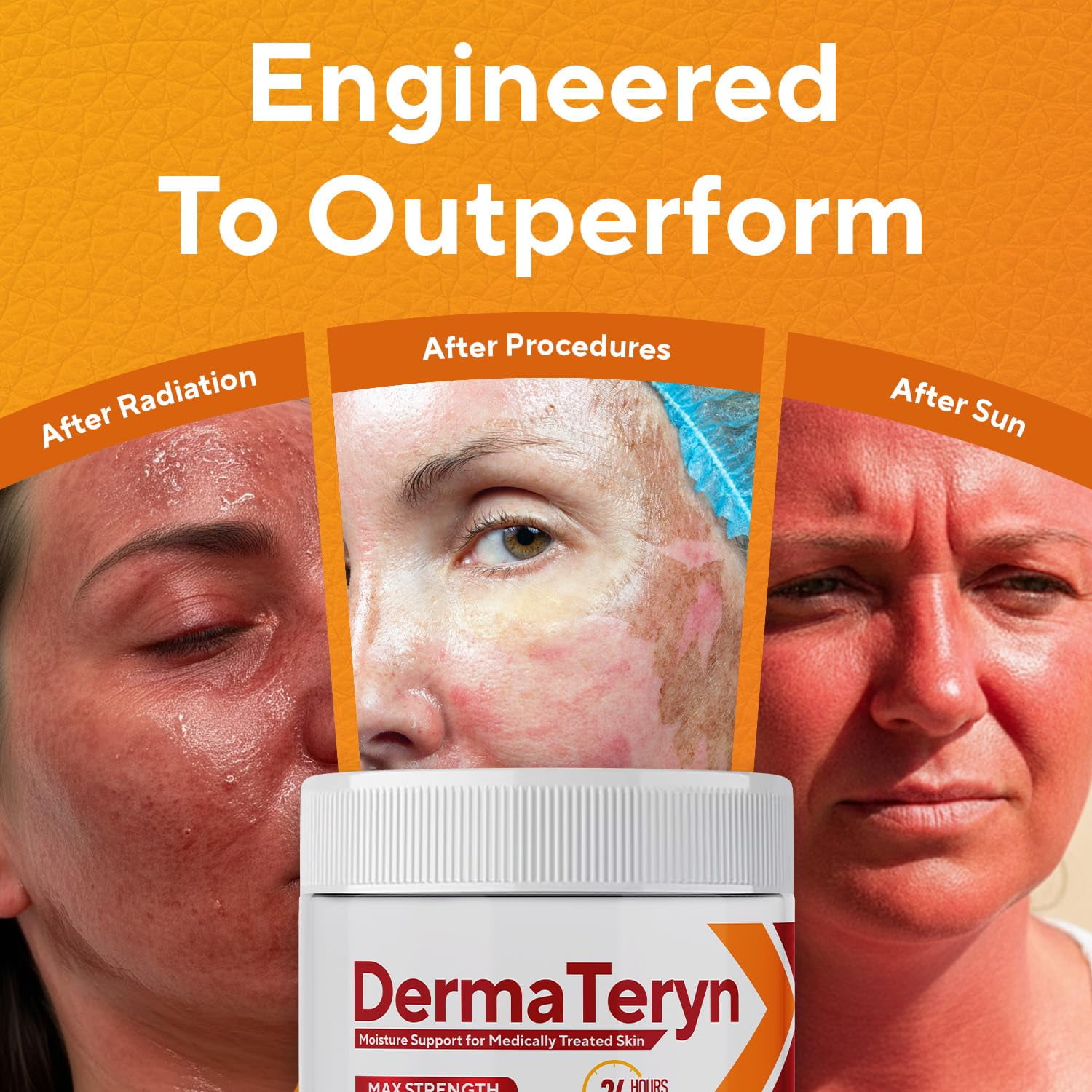 Marie Originals DermaTeryn Sunburn & Post Radiation Cream, Max Strength Moisture Barrier for Dry, Irritated or Sensitive Skin, Fragrance Free4 fl. Oz