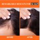 thumbnail image 3 of Aceite de batana Oil Well's, 59 ml, 100% natural y orgánico crudo, 3 of 9