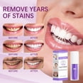 thumbnail image 3 of Mousse de limpieza dental V34, prensa embotellada púrpura, pasta de dientes, refresca el aliento, blanquea las manchas de los dientes, eliminación de manchas, limpieza dental, 3 of 4