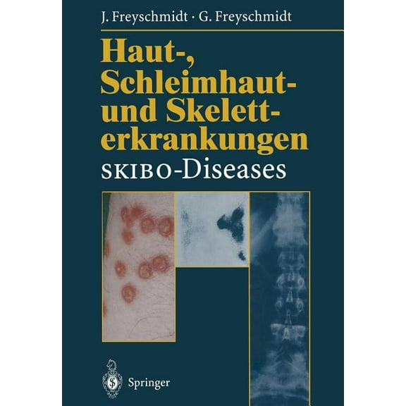 Haut-, Schleimhaut- Und Skeletterkrankungen Skibo-Diseases: Eine Dermatologische-Klinisch-Radiologische Synopse, (Paperback)