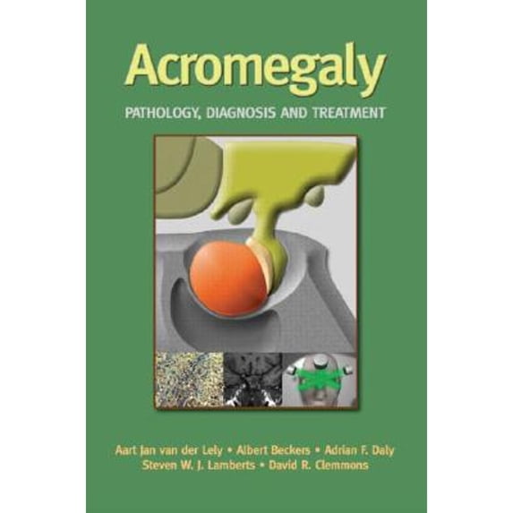 Pre-Owned Acromegaly: Pathology, Diagnosis and Treatment (Hardcover) 0849338484 9780849338489