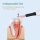 thumbnail image 3 of Cortador de encías dental inalámbrico ZHAOCHENG de gutapercha para dientes internos + 4 puntas, 3 of 5