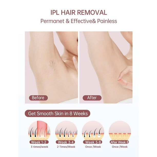 IPL Laser Hair Removal for Women and Men,Ice Compress Hair Removal System  Upgrade 999,900