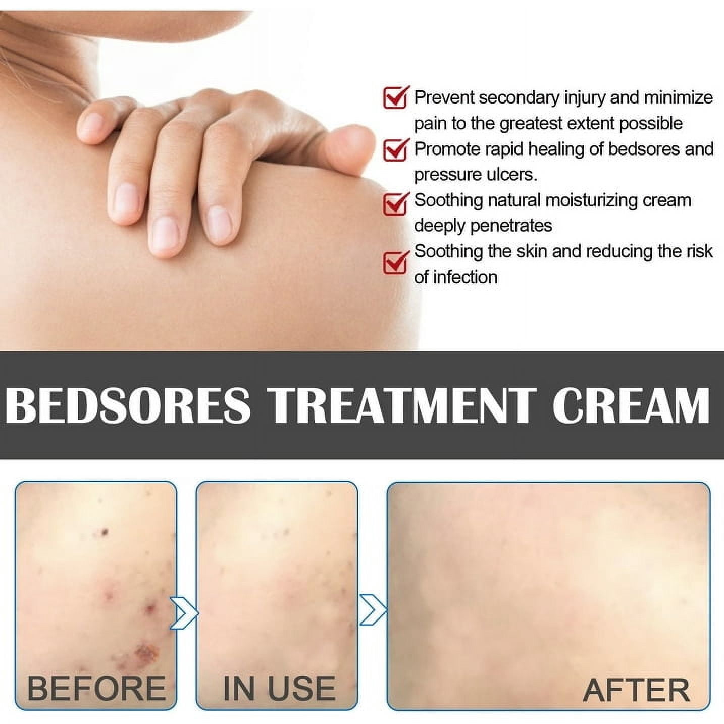 Decubitus Cream Pressure Sore Ulcer Skin Relief Ointment Bed Sore Wound Healing Treat Anti Dry Repair Moisturizing Body Care 20g