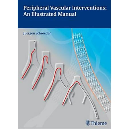 Illustrated Manual - Peripheral Vascular Interventions : An Illustrated Manual