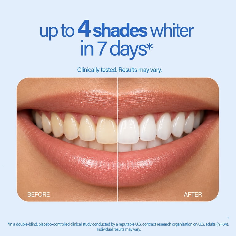 GuruNanda Teeth Whitening Strips, 7-Day Treatment photo 2