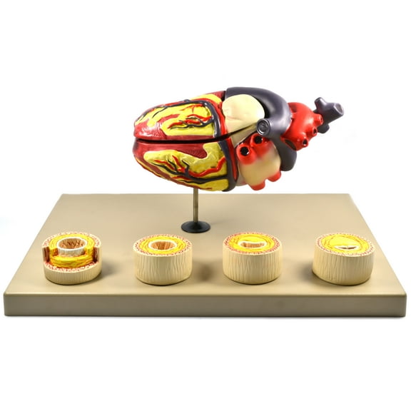 Eisco Labs Model of Human Heart Conditions Pathology; Larger than life size (10"); Artery Cross sections 2.5" in diameter